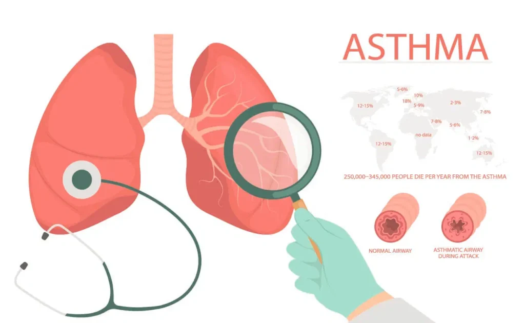 Asthma Home Remedies' Long-Term Efficacy