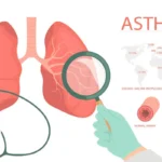 Asthma Home Remedies' Long-Term Efficacy