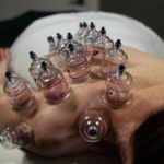 massage cupping in Pleasant Grove