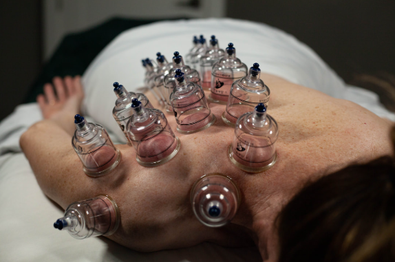 massage cupping in Pleasant Grove