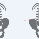 Pelvic and Spinal Issues