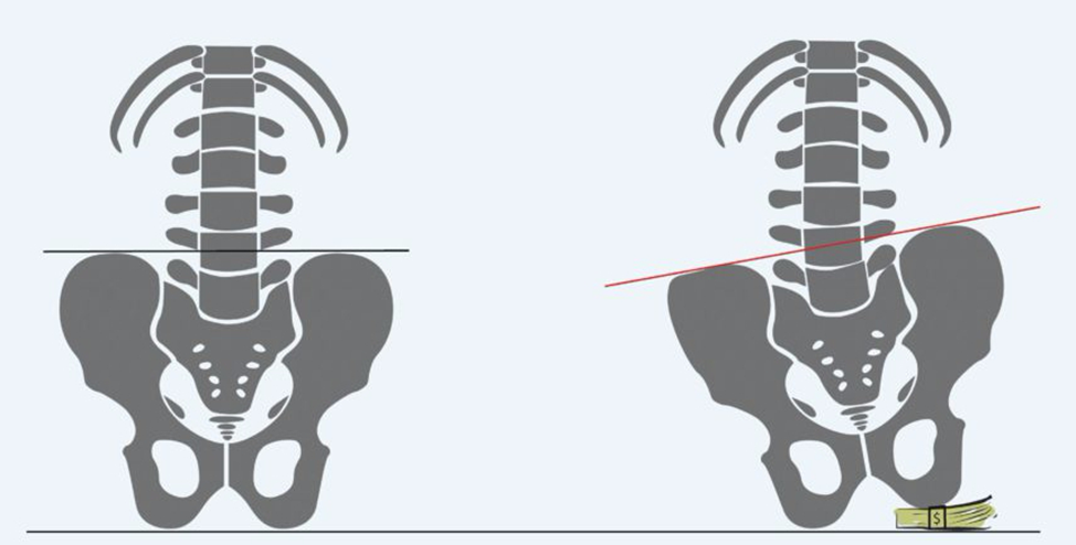 Pelvic and Spinal Issues