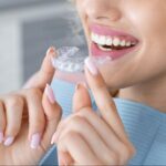 Aligners Dental